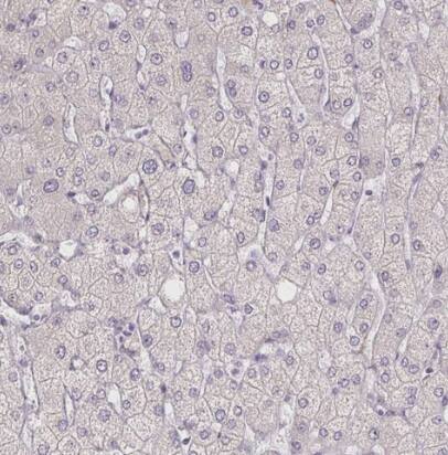 HRC Antibody
