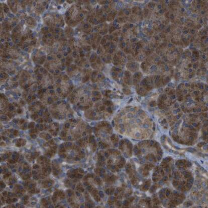 DPM3 Antibody