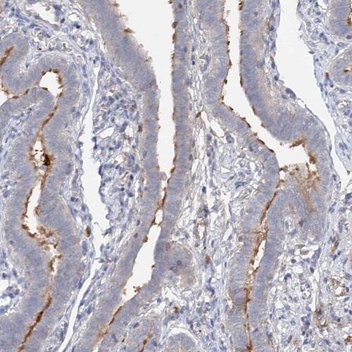 ALKBH8 Antibody - BSA Free Immunohistochemistry-Paraffin: ALKBH8 Antibody [NBP1-81238]