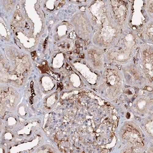 ALKBH8 Antibody - BSA Free Immunohistochemistry-Paraffin: ALKBH8 Antibody [NBP1-81238]