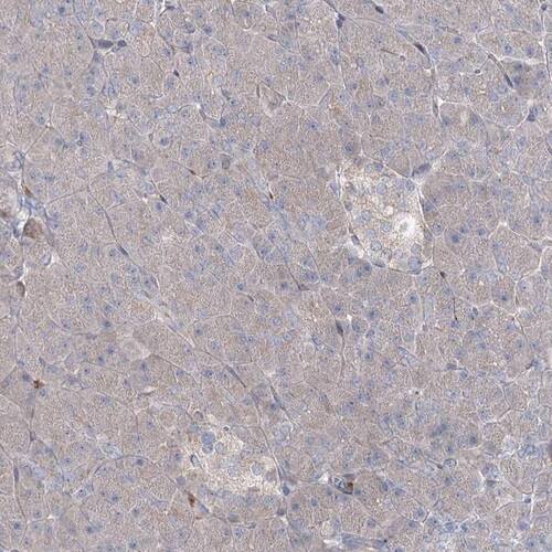 ALKBH8 Antibody - BSA Free Immunohistochemistry-Paraffin: ALKBH8 Antibody [NBP1-81238]