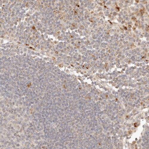 Lyp/PTPN22 Antibody - BSA Free Immunohistochemistry-Paraffin: Lyp/PTPN22 Antibody [NBP1-81277]