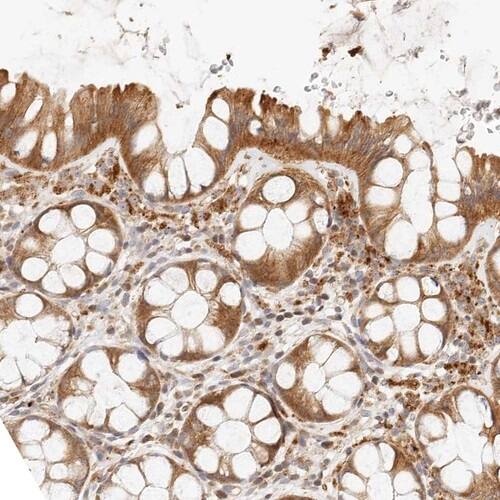 Lyp/PTPN22 Antibody - BSA Free Immunohistochemistry-Paraffin: Lyp/PTPN22 Antibody [NBP1-81277]