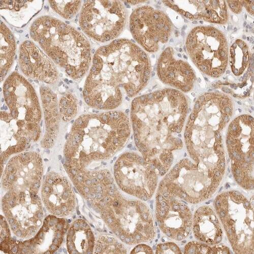 Lyp/PTPN22 Antibody - BSA Free Immunohistochemistry-Paraffin: Lyp/PTPN22 Antibody [NBP1-81277]