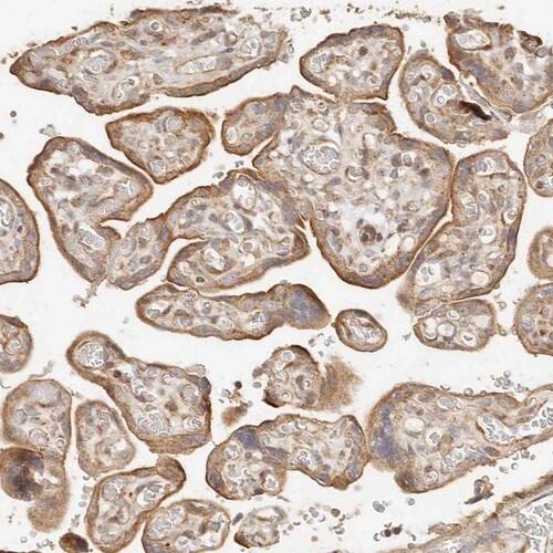 Lyp/PTPN22 Antibody - BSA Free Immunohistochemistry-Paraffin: Lyp/PTPN22 Antibody [NBP1-81277]