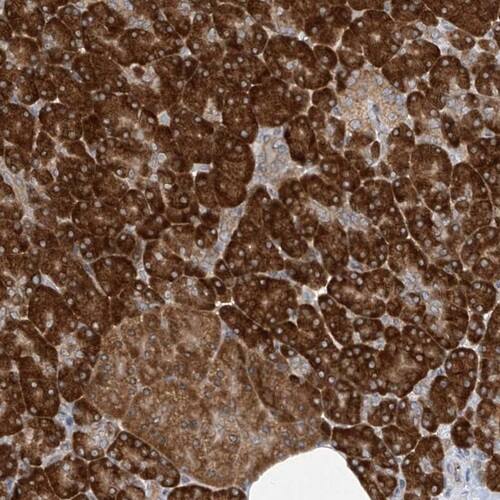 RPL34 Antibody - BSA Free Immunohistochemistry-Paraffin: RPL34 Antibody [NBP1-81331]