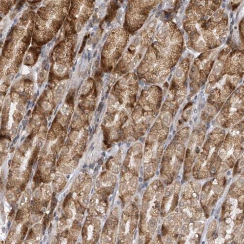 RPL34 Antibody - BSA Free Immunohistochemistry-Paraffin: RPL34 Antibody [NBP1-81331]