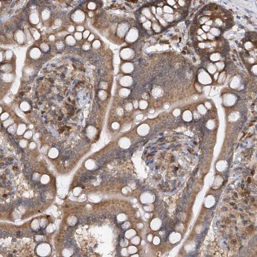 RPL34 Antibody - BSA Free Immunohistochemistry-Paraffin: RPL34 Antibody [NBP1-81331]