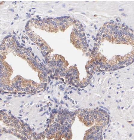 RPL11 Antibody