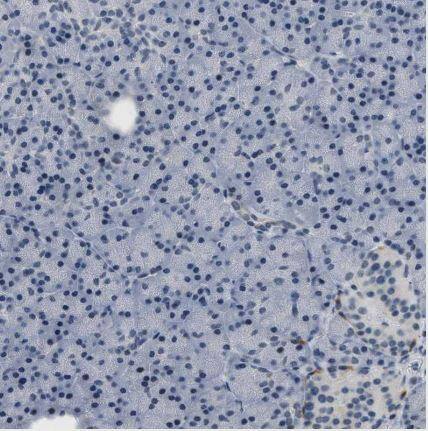 Kv3.3 Antibody