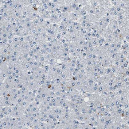 Kv3.3 Antibody