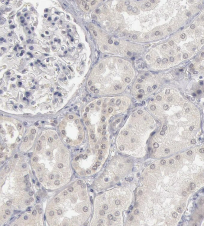 RIMBP3 Antibody - BSA Free