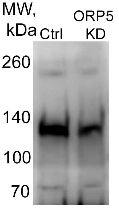 OSBPL5 Antibody