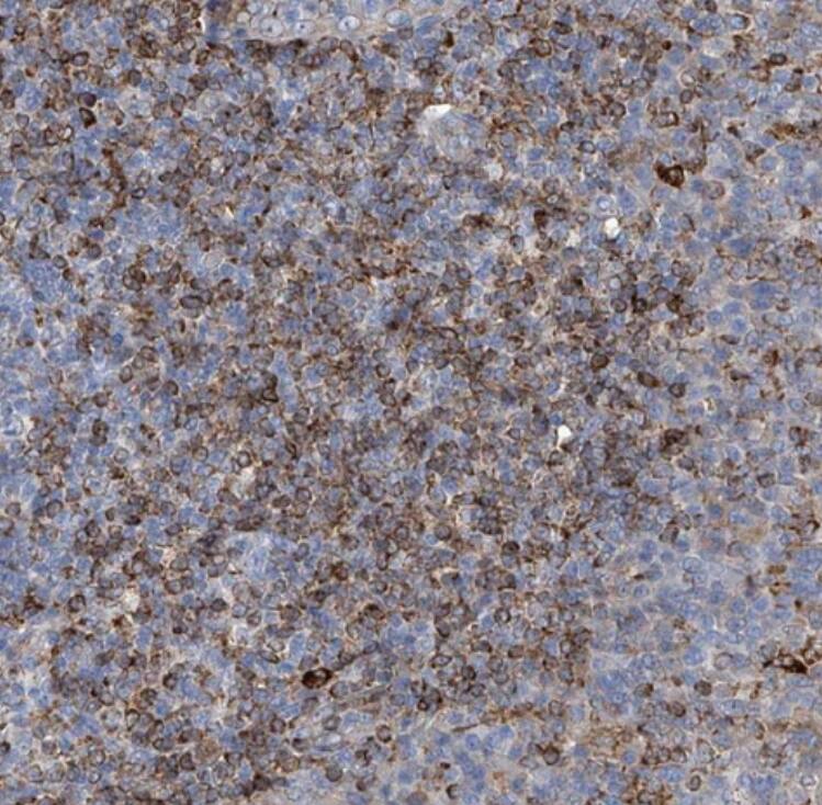 UBOX5 Antibody - BSA Free