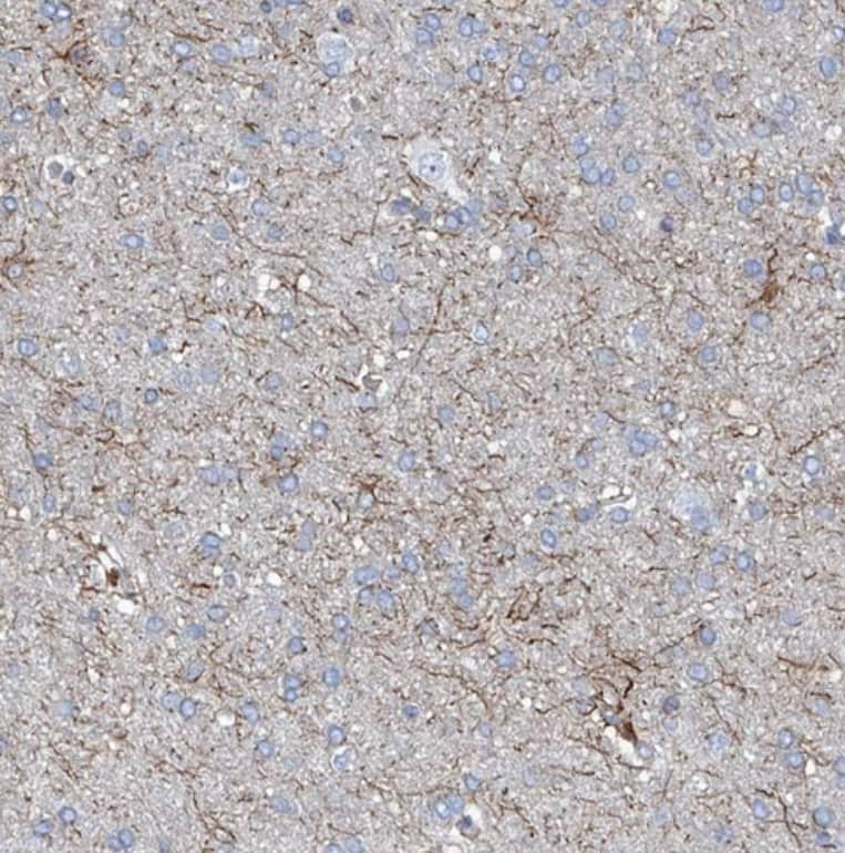 UBOX5 Antibody - BSA Free