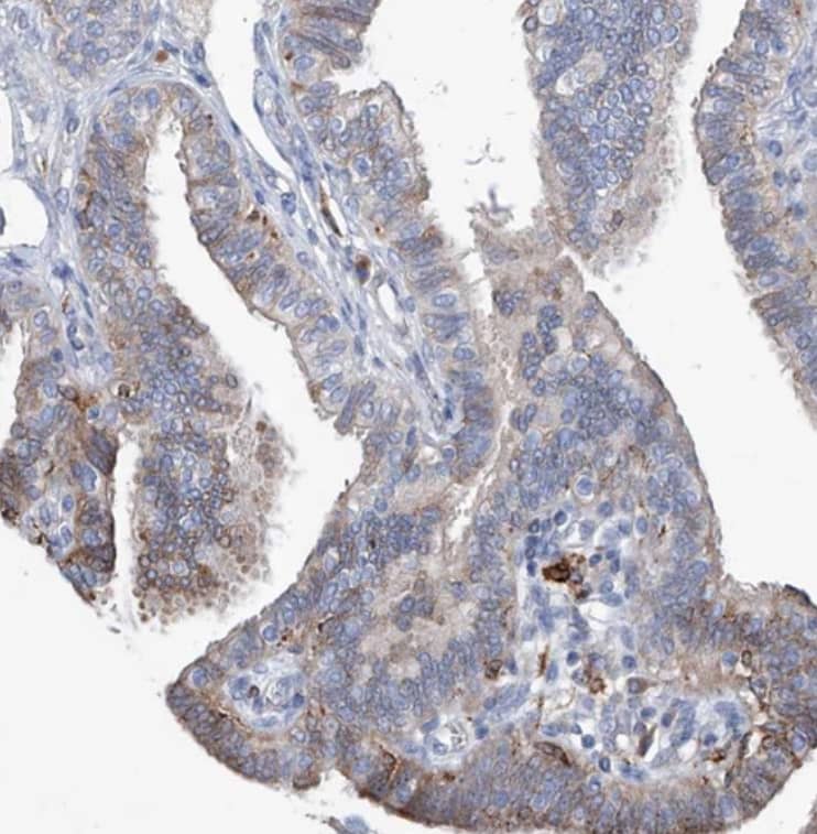 UBOX5 Antibody - BSA Free