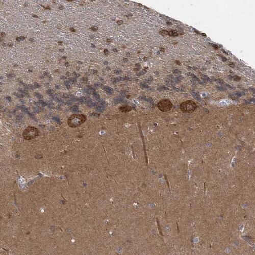 TRIM2 Antibody - BSA Free Immunohistochemistry-Paraffin: TRIM2 Antibody [NBP1-81504]