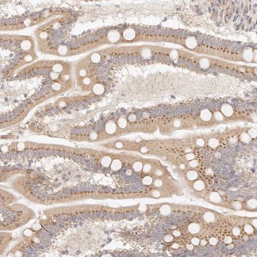 FAM20B Antibody - BSA Free Immunohistochemistry-Paraffin: FAM20B Antibody [NBP1-81506]