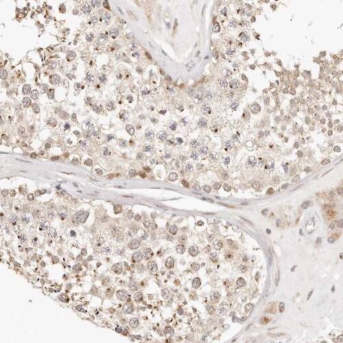 FAM20B Antibody - BSA Free Immunohistochemistry-Paraffin: FAM20B Antibody [NBP1-81506]