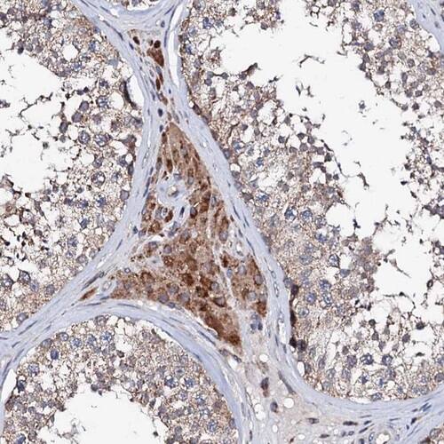 UBE3C Antibody - BSA Free Immunohistochemistry-Paraffin: UBE3C Antibody [NBP1-81558]