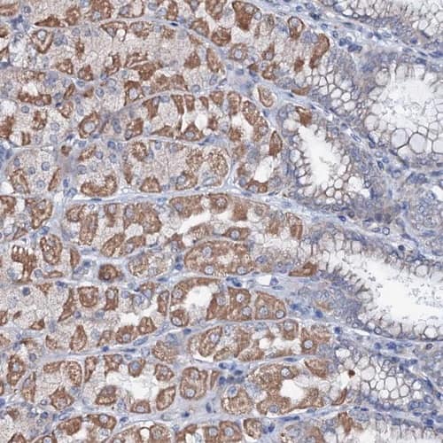 UBE3C Antibody - BSA Free Immunohistochemistry-Paraffin: UBE3C Antibody [NBP1-81558]
