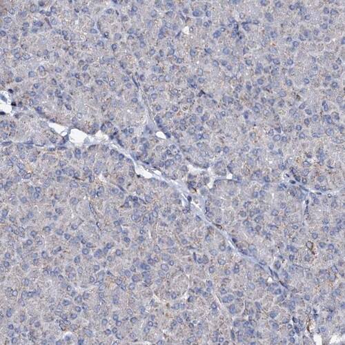 UBE3C Antibody - BSA Free Immunohistochemistry-Paraffin: UBE3C Antibody [NBP1-81558]