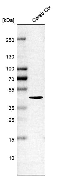 ITPKA Antibody Western Blot: ITPKA Antibody [NBP1-81590]
