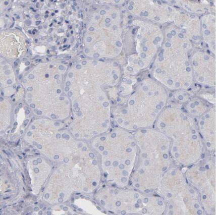 IRF8 Antibody