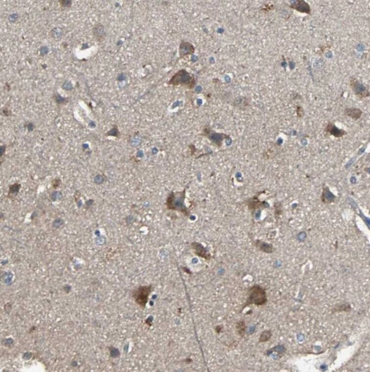 Glucokinase/GCK Antibody - BSA Free