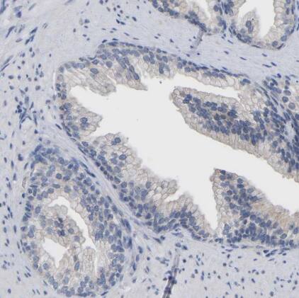 CREM Antibody