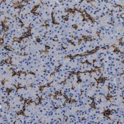 ADCY10 Antibody