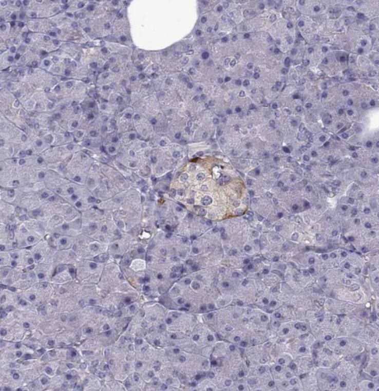 Glutaminyl-peptide Cyclotransferase/QPCT Antibody - BSA Free