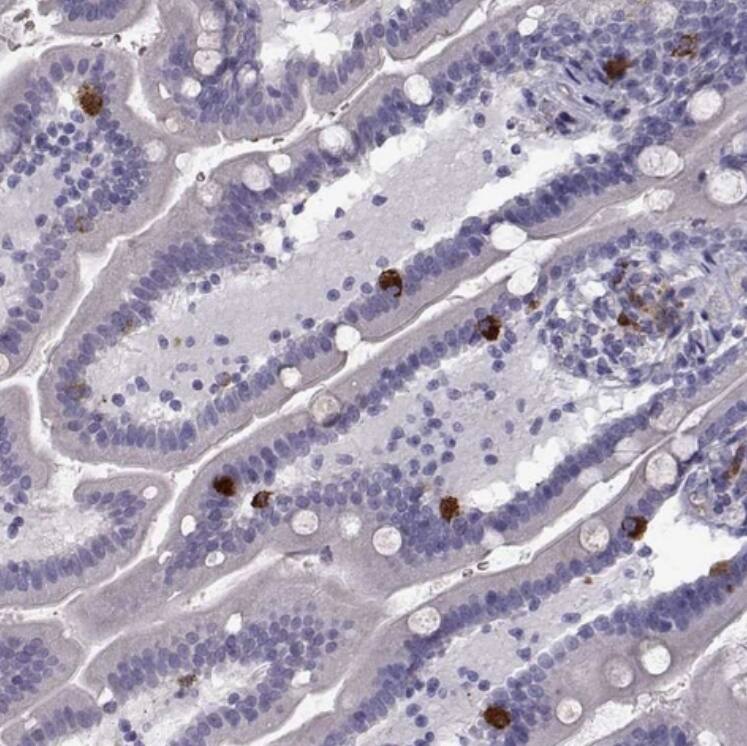 Glutaminyl-peptide Cyclotransferase/QPCT Antibody - BSA Free