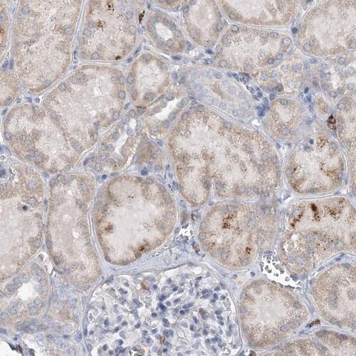 PRMT10 Antibody - BSA Free Immunohistochemistry-Paraffin: PRMT10 Antibody [NBP1-81887] -