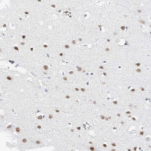 PRMT10 Antibody - BSA Free Immunohistochemistry-Paraffin: PRMT10 Antibody [NBP1-81887]