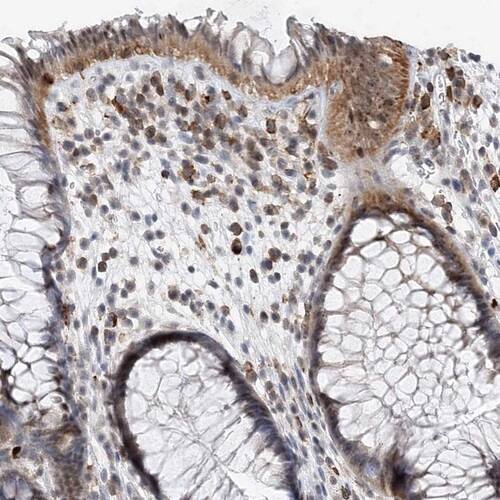 PRMT10 Antibody - BSA Free Immunohistochemistry-Paraffin: PRMT10 Antibody [NBP1-81887]