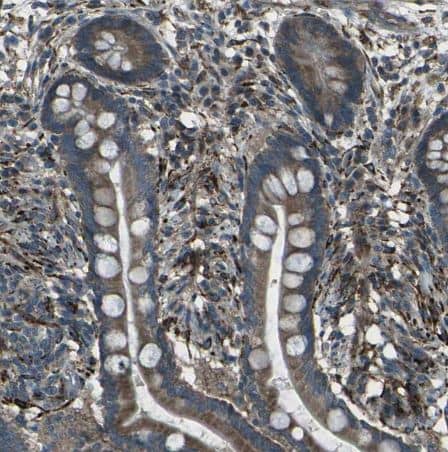LSMEM1 Antibody