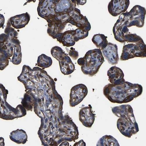 TFG Antibody - BSA Free Immunohistochemistry-Paraffin: TFG Antibody [NBP1-81957]