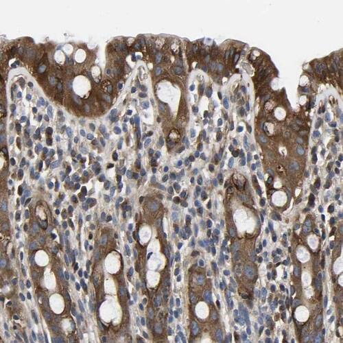 TFG Antibody - BSA Free Immunohistochemistry-Paraffin: TFG Antibody [NBP1-81957]