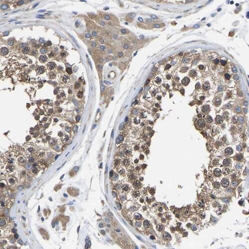 TFG Antibody - BSA Free Immunohistochemistry-Paraffin: TFG Antibody [NBP1-81957]