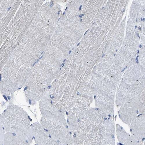 TFG Antibody - BSA Free Immunohistochemistry-Paraffin: TFG Antibody [NBP1-81957]