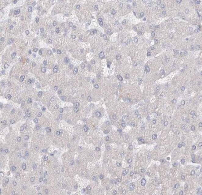 RNF145 Antibody - BSA Free