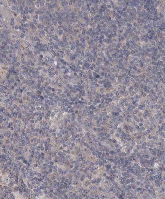 LRRC40 Antibody - BSA Free