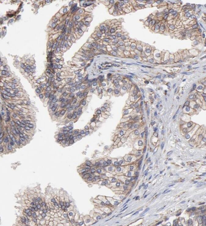 ARMT1 Antibody - BSA Free