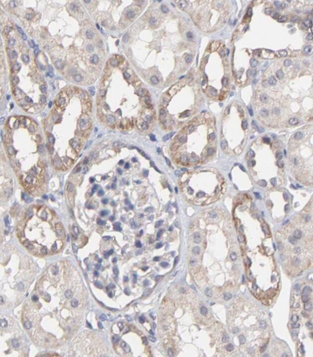 ARMT1 Antibody - BSA Free
