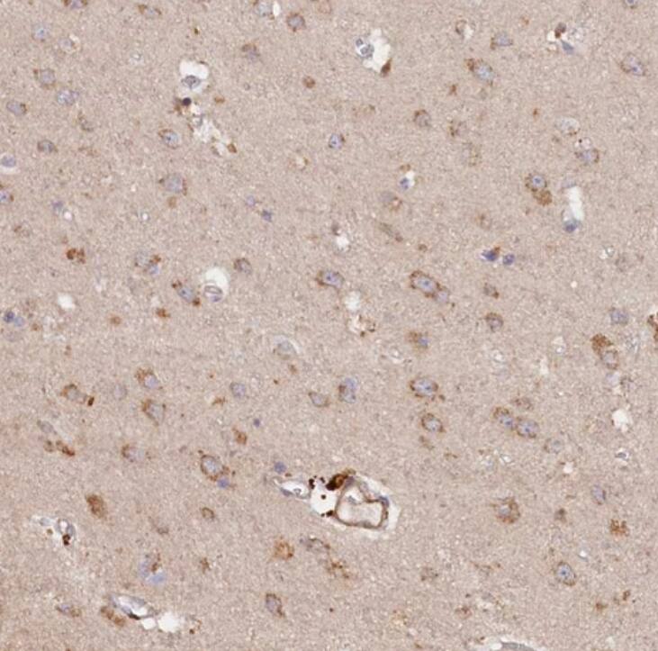 TMCO7 Antibody - BSA Free