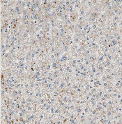 USP46 Antibody