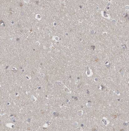 P2Y10/P2RY10 Antibody