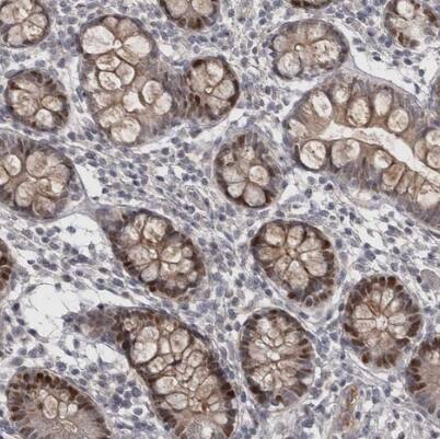 ZNF277 Antibody - BSA Free