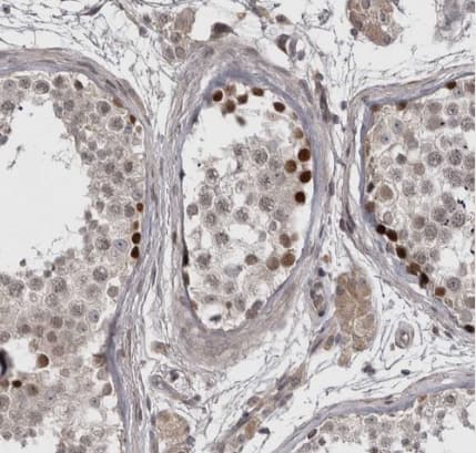 ZNF277 Antibody - BSA Free